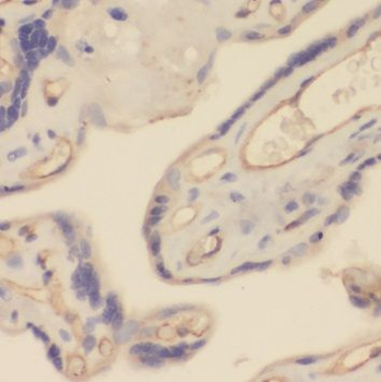 TRPC6 Antibody
