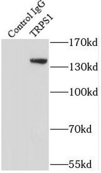 TRPS1 Rabbit Polyclonal Antibody