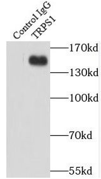 TRPS1 Rabbit Polyclonal Antibody