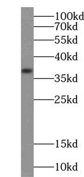 TRUB1 Antibody