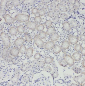 TRUB1 Antibody
