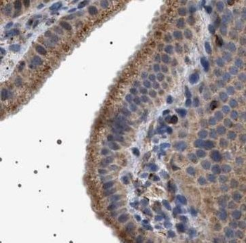 TRUB2 Rabbit Polyclonal Antibody