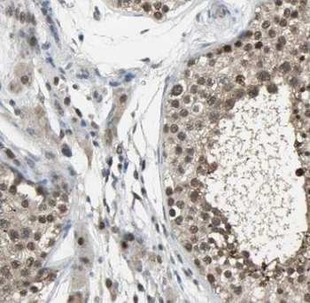 TSC22D1 Antibody