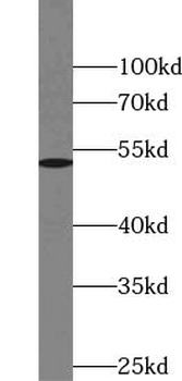TSEN2 Antibody