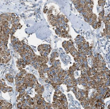 TSFM Antibody