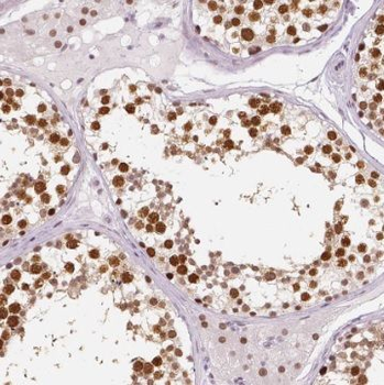 TSGA13 Antibody