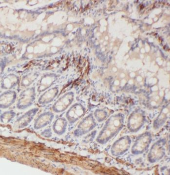 TSPAN1 Antibody