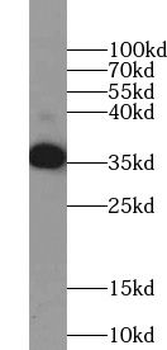 TSPAN11 Antibody