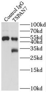 TSPAN7 Antibody