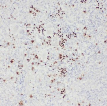 TSPAN7 Antibody