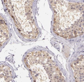 TSPY3 Antibody