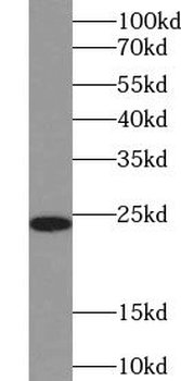 TSR2 Antibody