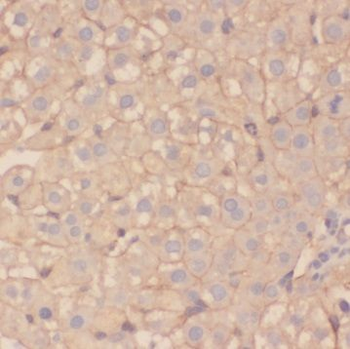 TSR2 Antibody