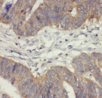 TST Antibody