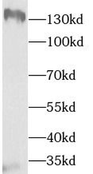TTBK2 Antibody