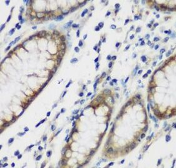 TTBK2 Antibody