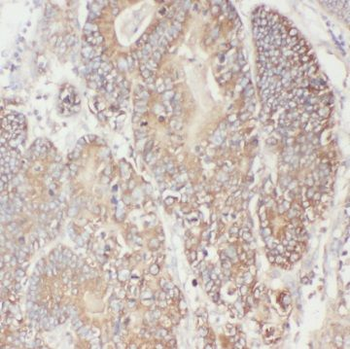 TTC1 Antibody