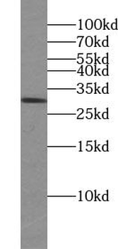 TTC32 Antibody
