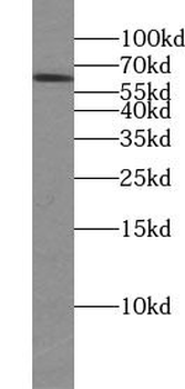 TTC39B Antibody