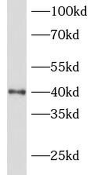 NKX2 1 Rabbit Polyclonal Antibody