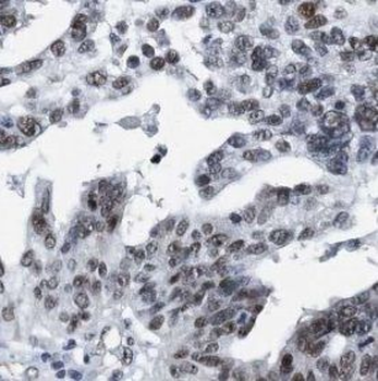TTF2 Antibody