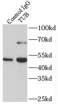 TUB Rabbit Polyclonal Antibody