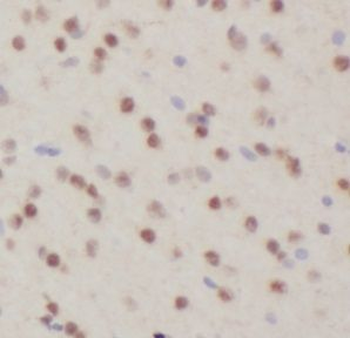TUB Rabbit Polyclonal Antibody