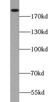 TSC2 Rabbit Polyclonal Antibody