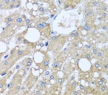 TUBGCP3 Antibody