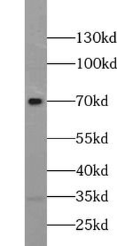TULP1 Antibody