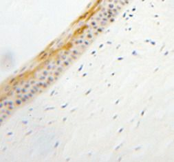 TULP1 Antibody