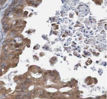 TULP3 Antibody