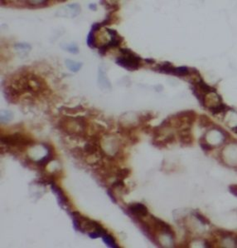 TULP4 Antibody