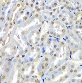 TUSC2 Antibody