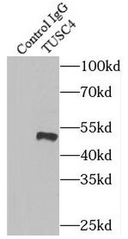 NPRL2 Antibody