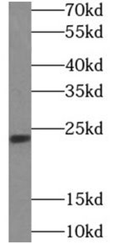 TWIST1 Rabbit Polyclonal Antibody