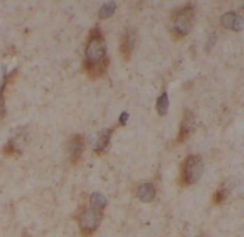 TWSG1 Antibody