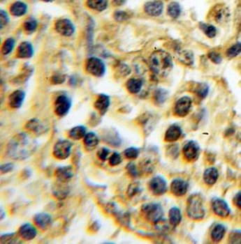 TXK Rabbit Polyclonal Antibody