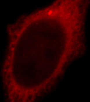 TXNDC17 Antibody