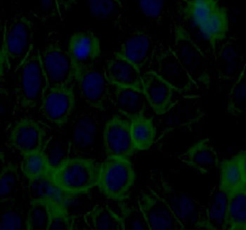 TXNIP Antibody