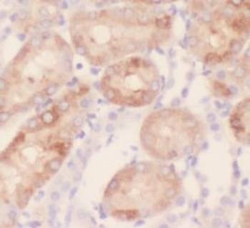 TXNIP Antibody