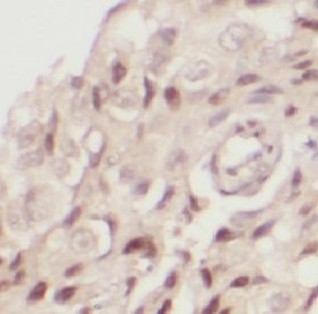 TXNRD1 Antibody