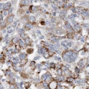 TXNRD2 Antibody