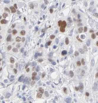 DDX39B Antibody