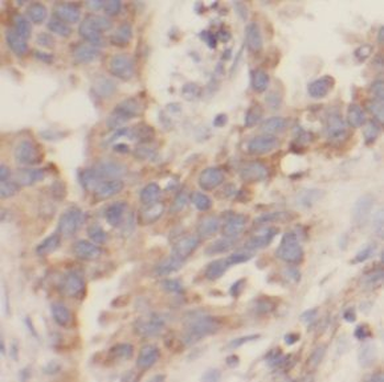 UBAP1 Antibody