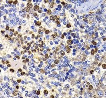 UBASH3B Antibody