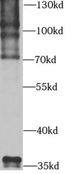 UBC Rabbit Polyclonal Antibody