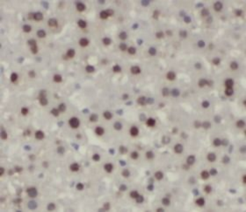 UBC Rabbit Polyclonal Antibody
