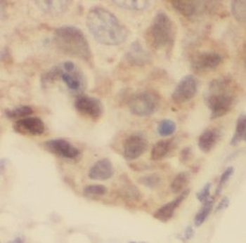 UBE2N Antibody