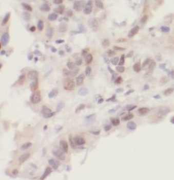 UBE2I Antibody
